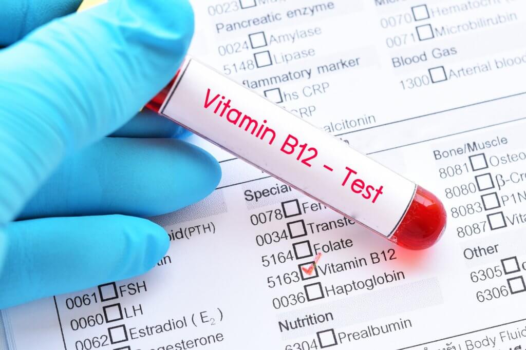 Welche Faktoren es bei dem Kauf die Vitamin b12 spritze beim arzt kosten zu beurteilen gibt!